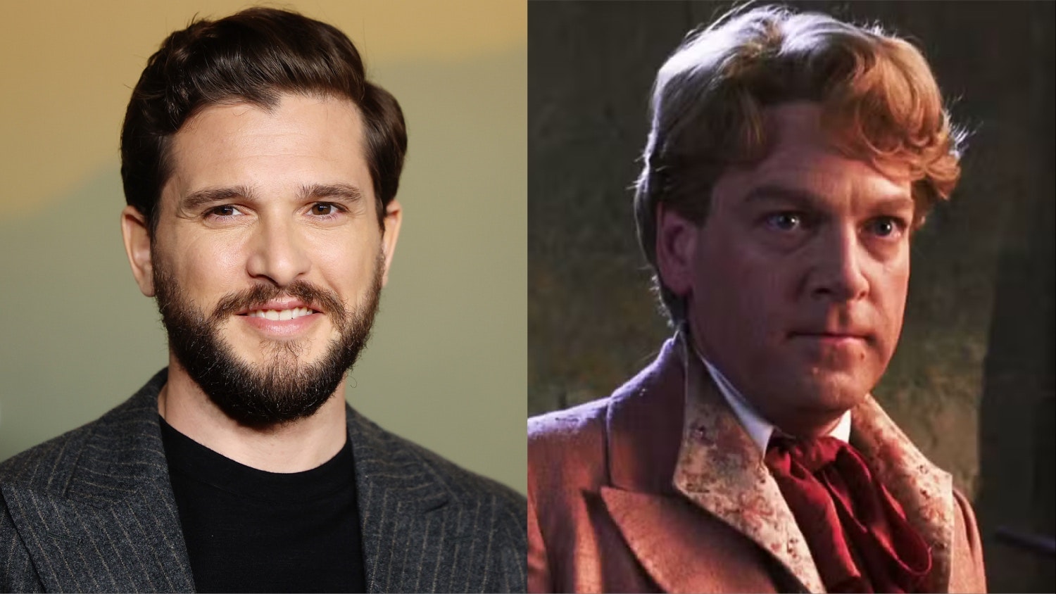 Kit Harington To Play Gilderoy Lockhart In HBO’s Harry Potter Series As Nicholas Hoult Exits